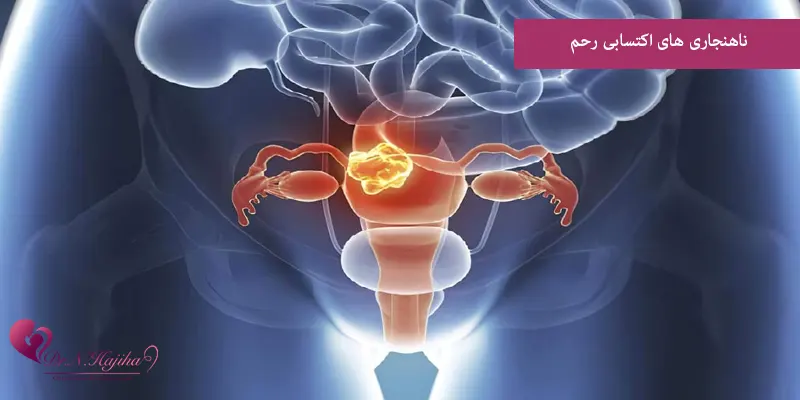 ناهنجاری های اکتسابی رحم