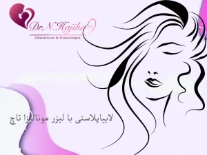لابیاپلاستی با لیزر مونالیزا تاچ