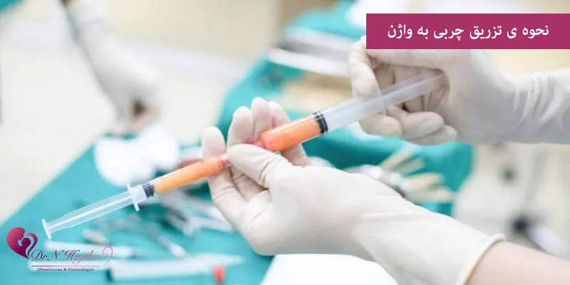 نحوه ی تزریق چربی به واژن