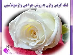 تنگ کردن واژن به روش جراحی