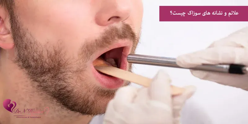 علائم و نشانه های سوزاک چیست؟