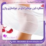 عملکرد لیزر مونالیزا تاچ در جوانسازی واژن