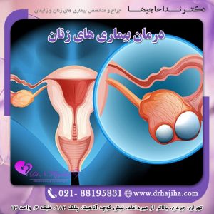 بیماری های زنان