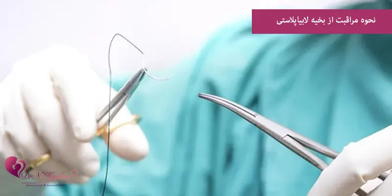 نحوه مراقبت از بخیه لابیاپلاستی