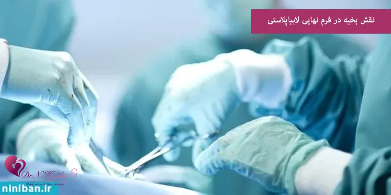 نقش بخیه در فرم نهایی لابیاپلاستی