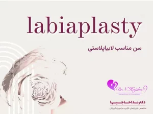 سن مناسب لابیاپلاستی