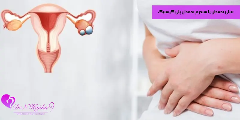 تنبلی-تخمدان-یا-سندرم-تخمدان-پلی-کیستیک