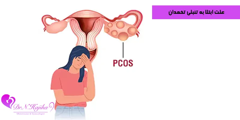 علت-ابتلا-به-تنبلی-تخمدان