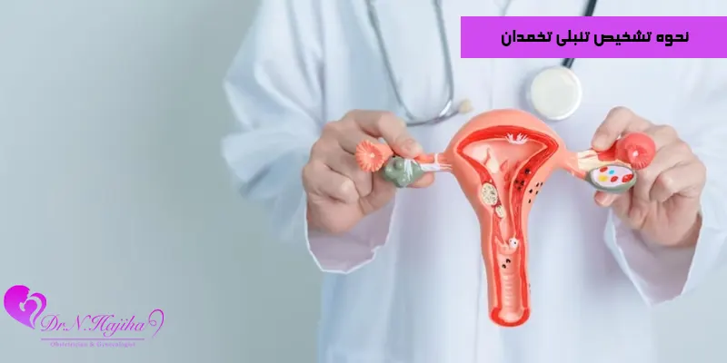 نحوه-تشخیص-تنبلی-تخمدان