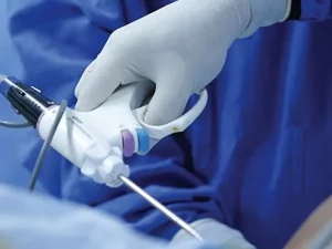 هیستروسکوپی رحم