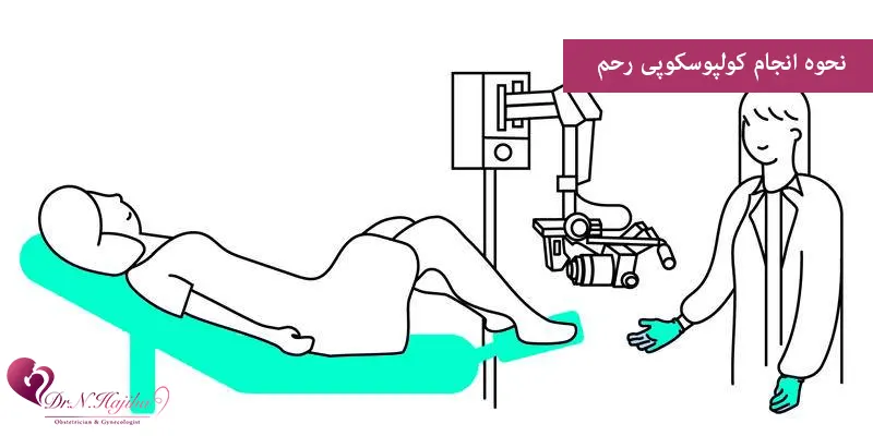 نحوه-انجام-کولپوسکوپی-رحم
