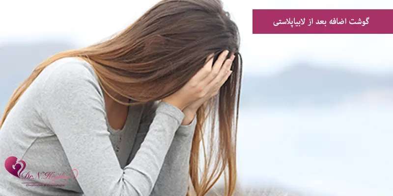 گوشت اضافه بعد از لابیاپلاستی